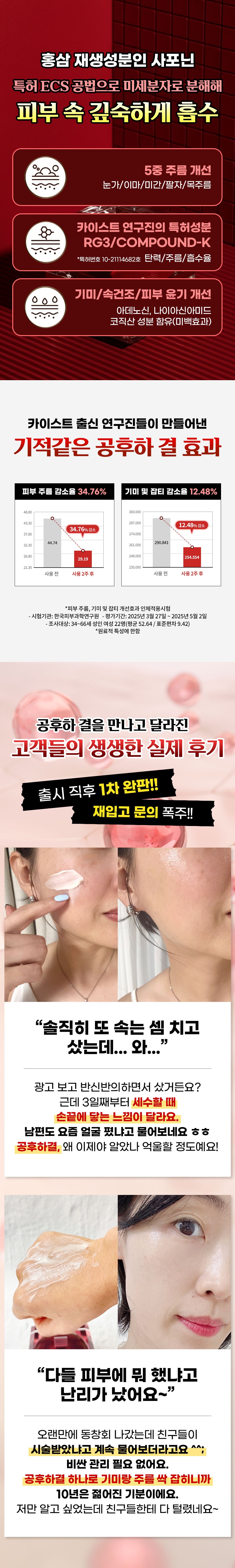 4070 여성 피부 고민에 맞춘 카이스트 연구진의 특허크림 공후하 결 파격혜택
